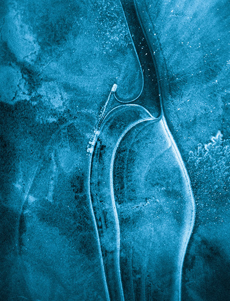 Galactic Ice